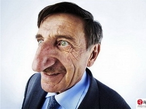 Người đàn ông có chiếc mũi dài nhất thế giới. Nguồn: Internet.