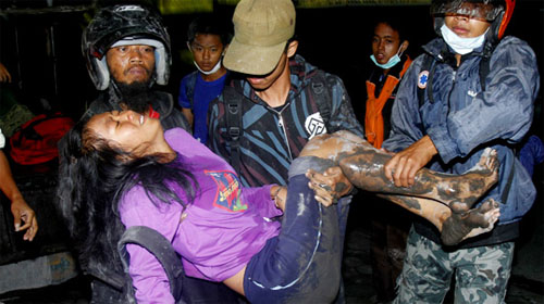 Một người dân bị phỏng nặng khi núi lửa tấn công - Ảnh: AP